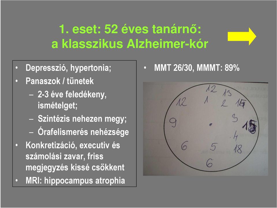 nehezen megy; Órafelismerés nehézsége Konkretizáció, executiv és számolási