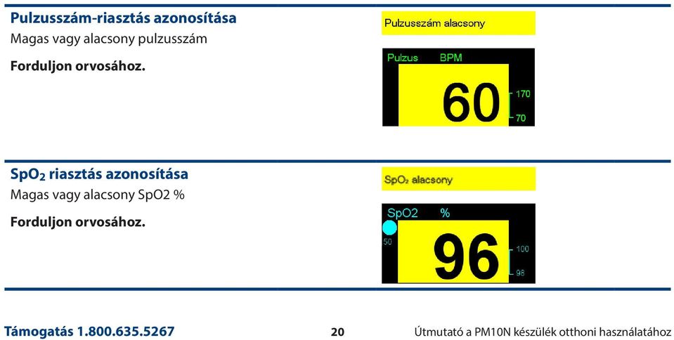 SpO 2 riasztás azonosítása Magas vagy alacsony SpO2 %