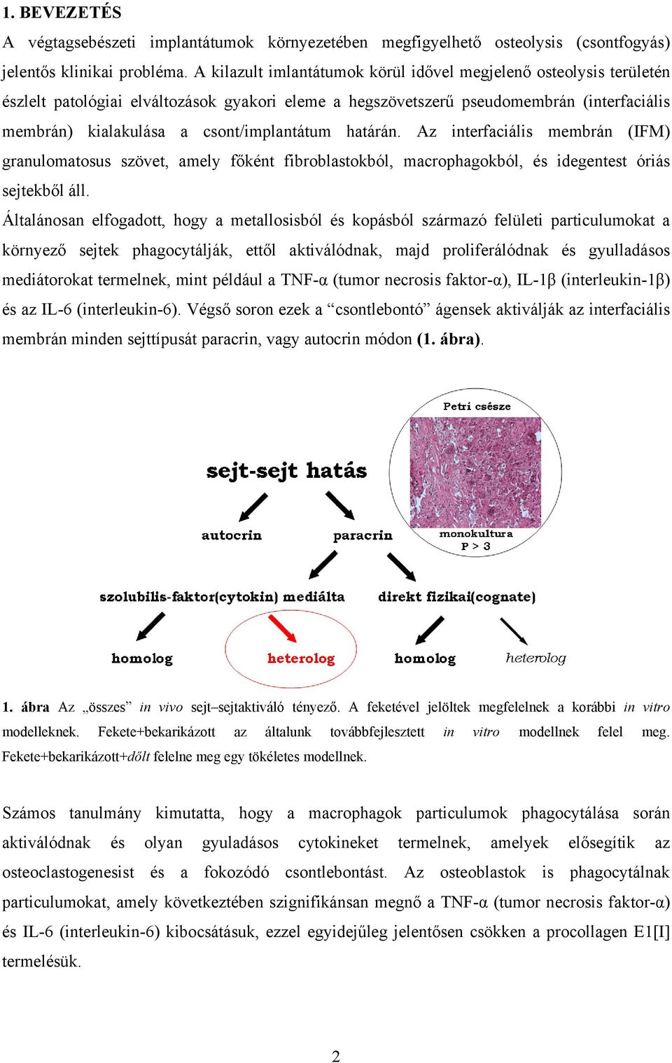 csont/implantátum határán. Az interfaciális membrán (IFM) granulomatosus szövet, amely főként fibroblastokból, macrophagokból, és idegentest óriás sejtekből áll.