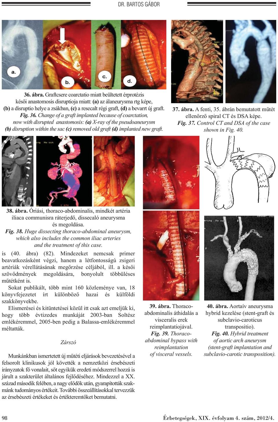 iliac sac kezelés