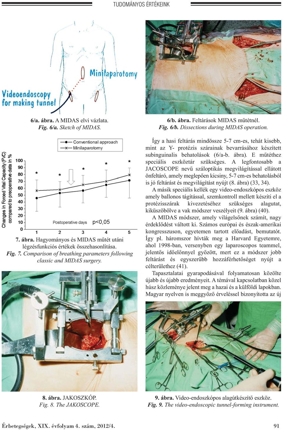 Így a hasi feltárás mindössze 5-7 cm-es, tehát kisebb, mint az Y- protézis szárainak bevarrásához készített subinguinalis behatolások (6/a-b. ábra). E műtéthez speciális eszköztár szükséges.