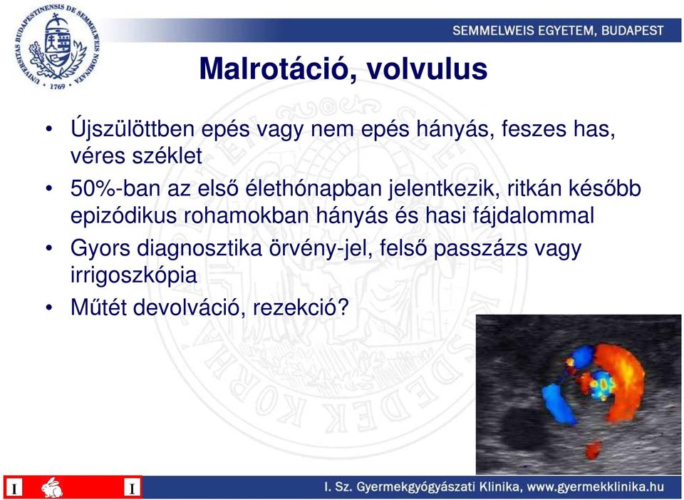 késıbb epizódikus rohamokban hányás és hasi fájdalommal Gyors