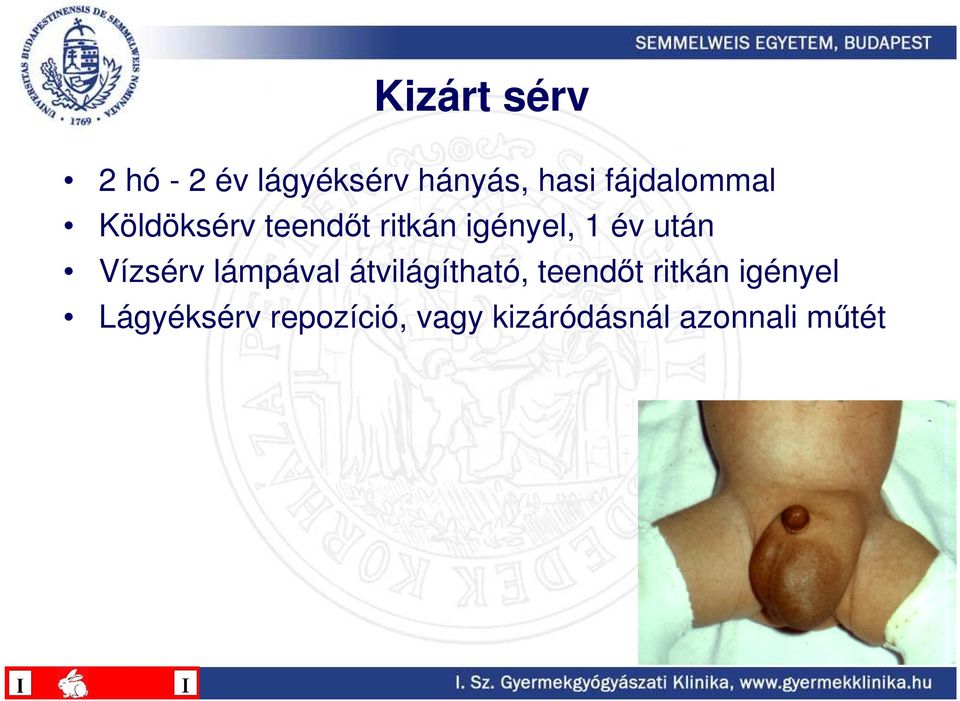 után Vízsérv lámpával átvilágítható, teendıt ritkán