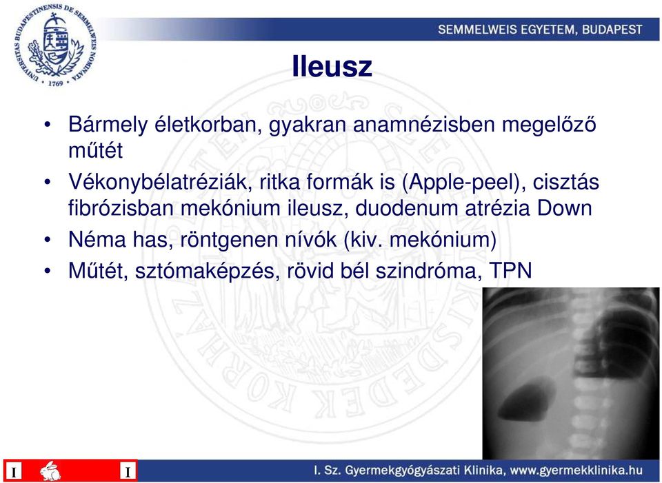 fibrózisban mekónium ileusz, duodenum atrézia Down Néma has,