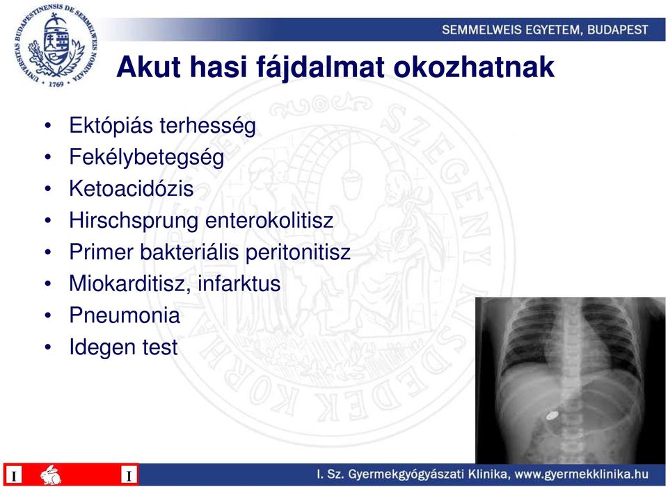 Hirschsprung enterokolitisz Primer