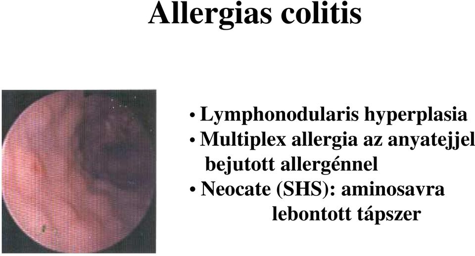 anyatejjel bejutott allergénnel