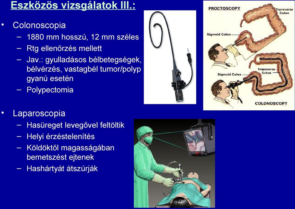 : gyulladásos bélbetegségek, bélvérzés, vastagbél tumor/polyp gyanú esetén