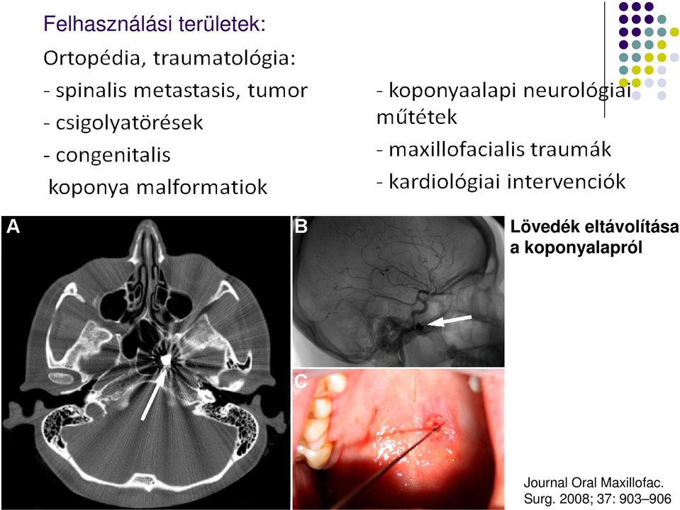 koponyalapról Journal Oral