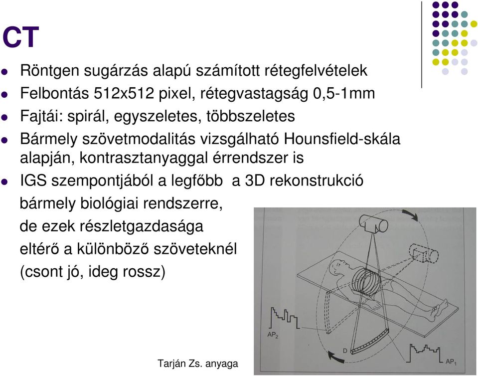 alapján, kontrasztanyaggal érrendszer is IGS szempontjából a legfőbb a 3D rekonstrukció bármely