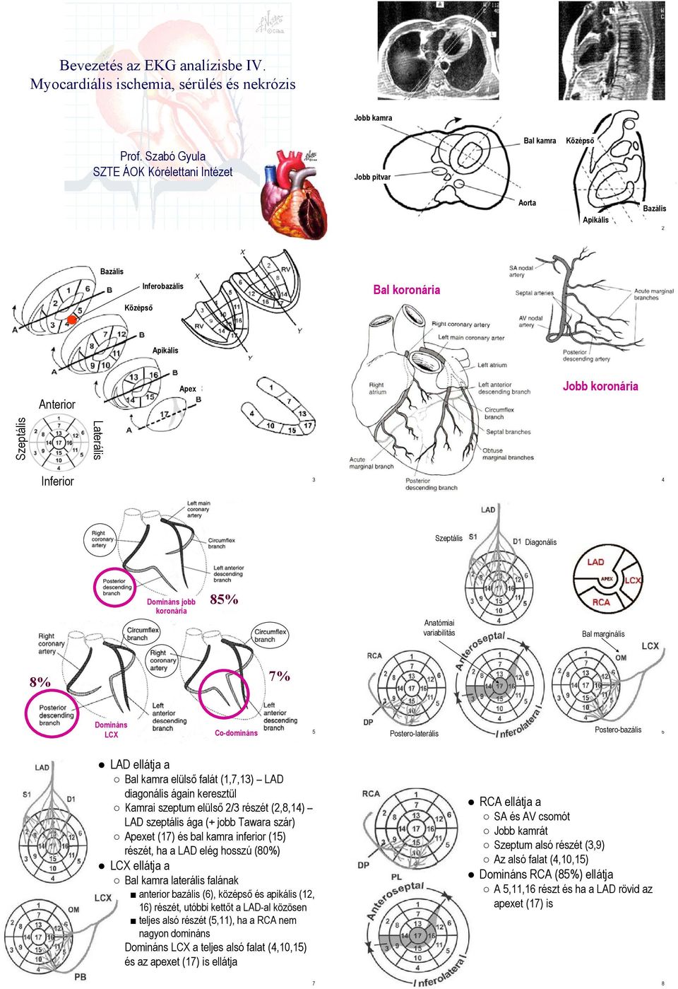 Diagonális Domináns jobb koronária 85% Anatómiai variabilitás Bal marginális 8% 7% Domináns Postero-laterális Postero-bazális 5 LCX Co-domináns 6 LAD ellátja a Bal kamra elülső falát (1,7,13) LAD