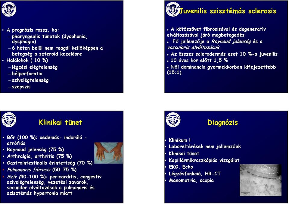 Az összes sclerodermás eset 10 %-a juvenilis 10 éves kor előtt 1,5 % Női dominancia gyermekkorban kifejezettebb (15:1) Klinikai tünet Bőr (100 %): oedemás- induráló - atrófiás Raynaud jelenség (75 %)