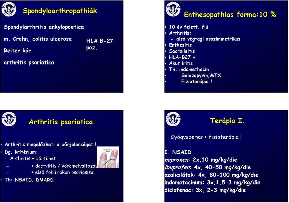 Fizioterápia! Arthritis psoriatica Terápia I. Arthritis megelőzheti a bőrjelenséget! Dg.