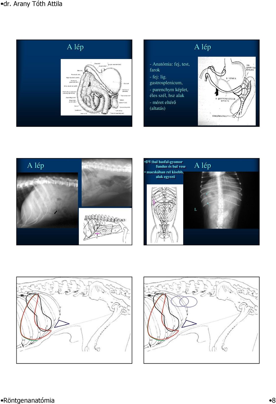 A lép DV:bal DV:balhasfal-gyomor hasfal-gyomor fundus fundusés ésbal balvese vese