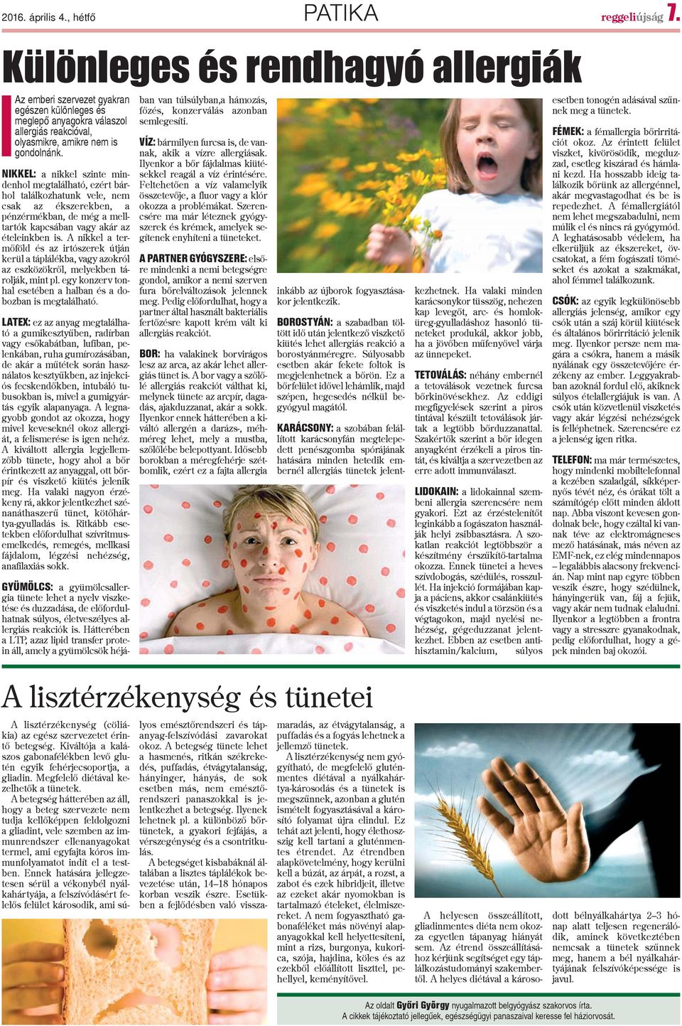 NIKKEL: a nikkel szinte mindenhol megtalálható, ezért bárhol találkozhatunk vele, nem csak az ékszerekben, a pénzérmékban, de még a melltartók kapcsában vagy akár az ételeinkben is.