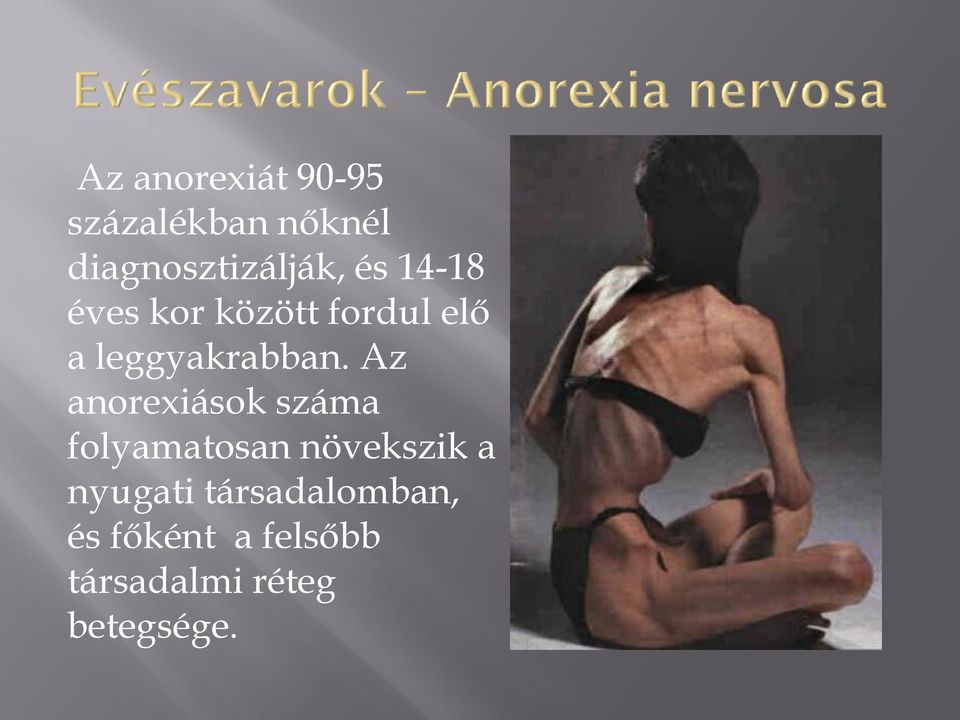 Az anorexiások száma folyamatosan növekszik a nyugati