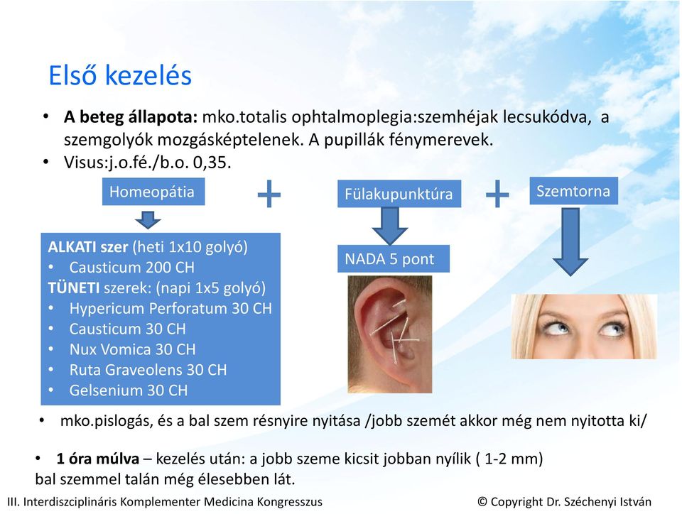 Homeopátia Fülakupunktúra Szemtorna ALKATI szer (heti 1x10 golyó) Causticum 200 CH TÜNETI szerek: (napi 1x5 golyó) Hypericum Perforatum 30 CH