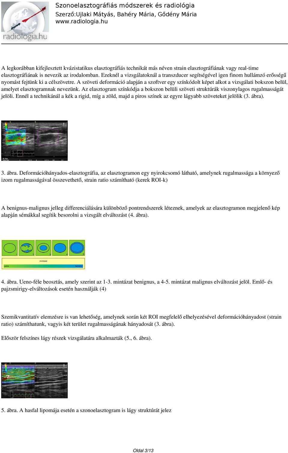 A szöveti deformáció alapján a szoftver egy színkódolt képet alkot a vizsgálati bokszon belül, amelyet elasztogramnak nevezünk.