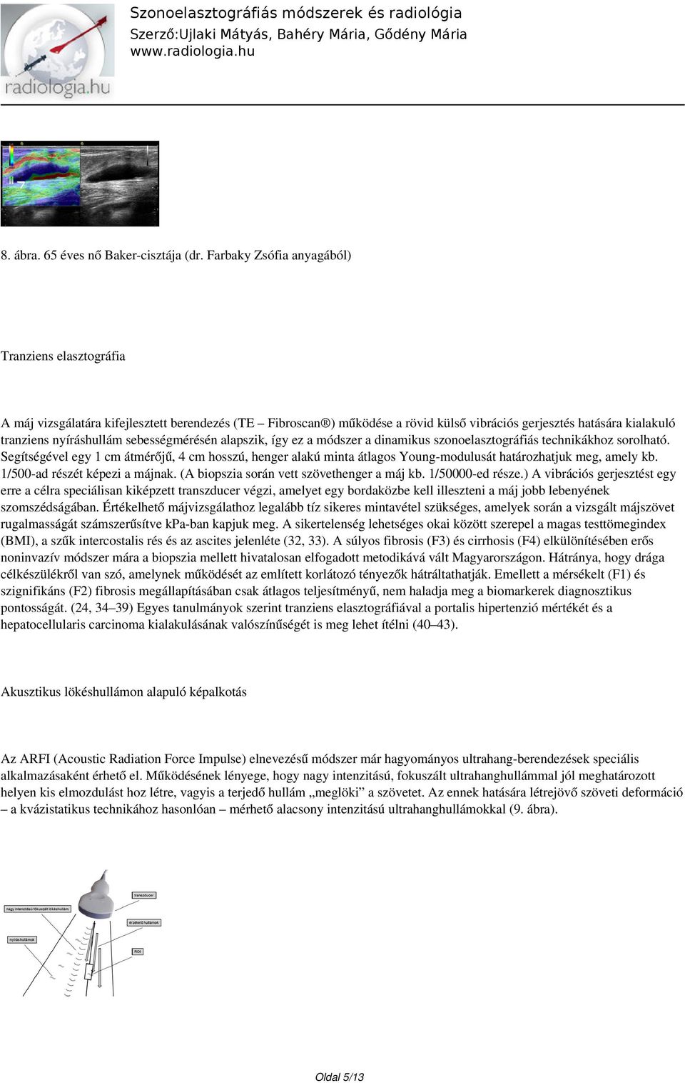 sebességmérésén alapszik, így ez a módszer a dinamikus szonoelasztográfiás technikákhoz sorolható.