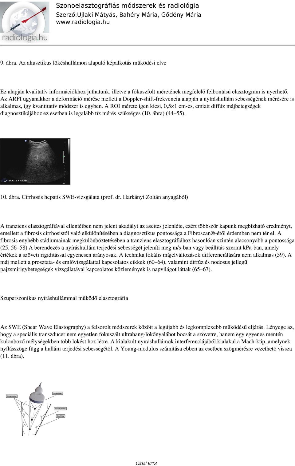 A ROI mérete igen kicsi, 0,5 1 cm-es, emiatt diffúz májbetegségek diagnosztikájához ez esetben is legalább tíz mérés szükséges (10. ábra) (44 55). 10. ábra. Cirrhosis hepatis SWE-vizsgálata (prof. dr.