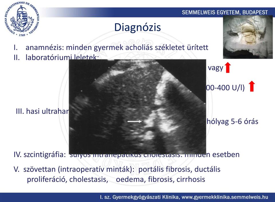 albumin: normális III.