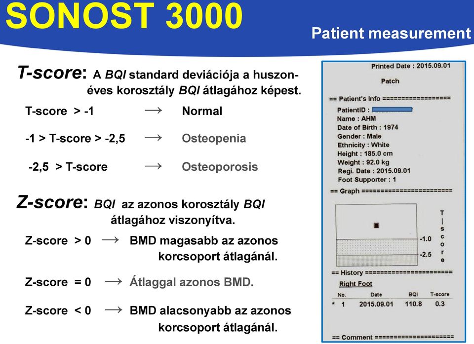 T-score > -1 Normal -1 > T-score > -2,5 Osteopenia -2,5 > T-score Osteoporosis Z-score: BQI az