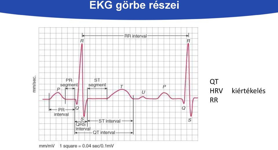 HRV RR