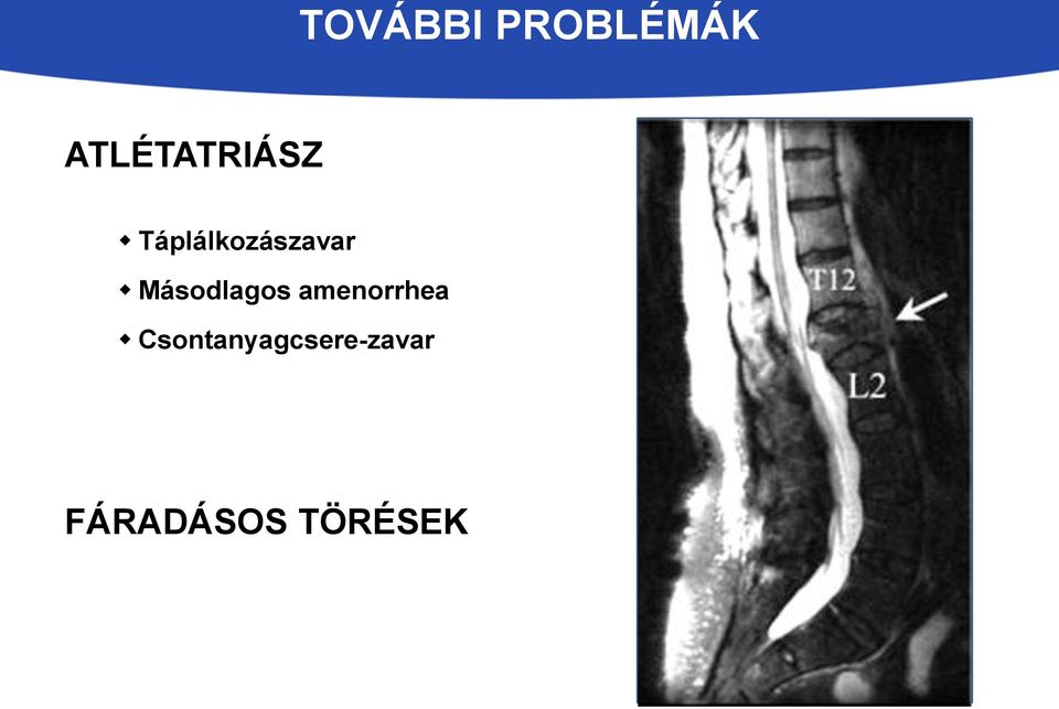 Táplálkozászavar Másodlagos