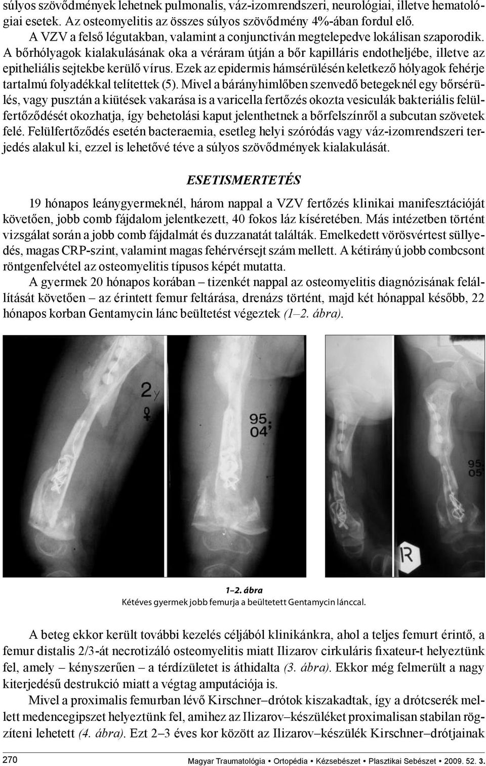 A bőrhólyagok kialakulásának oka a véráram útján a bőr kapilláris endotheljébe, illetve az epitheliális sejtekbe kerülő vírus.