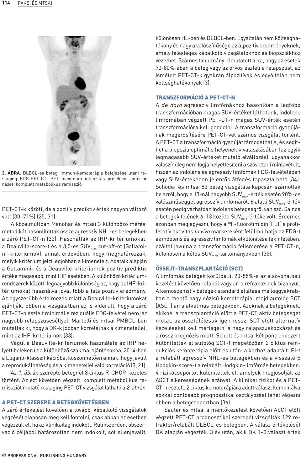 DLBCL-es beteg, immun-kemoterápia befejezése utáni restaging FDG-PET-CT, PET maximum intenzitás projekció, anterior nézet: komplett metabolikus remisszió PET-CT-k között, de a pozitív prediktív érték