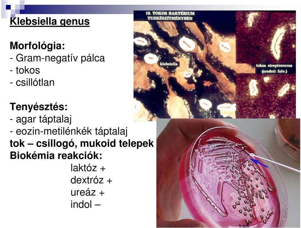 eozin-metilénkék táptalaj tok csillogó, mukoid