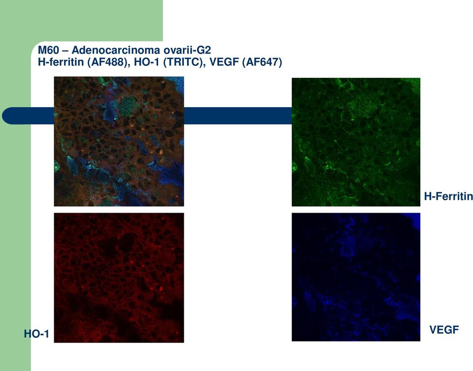 (AF488), HO-1 (TRITC),