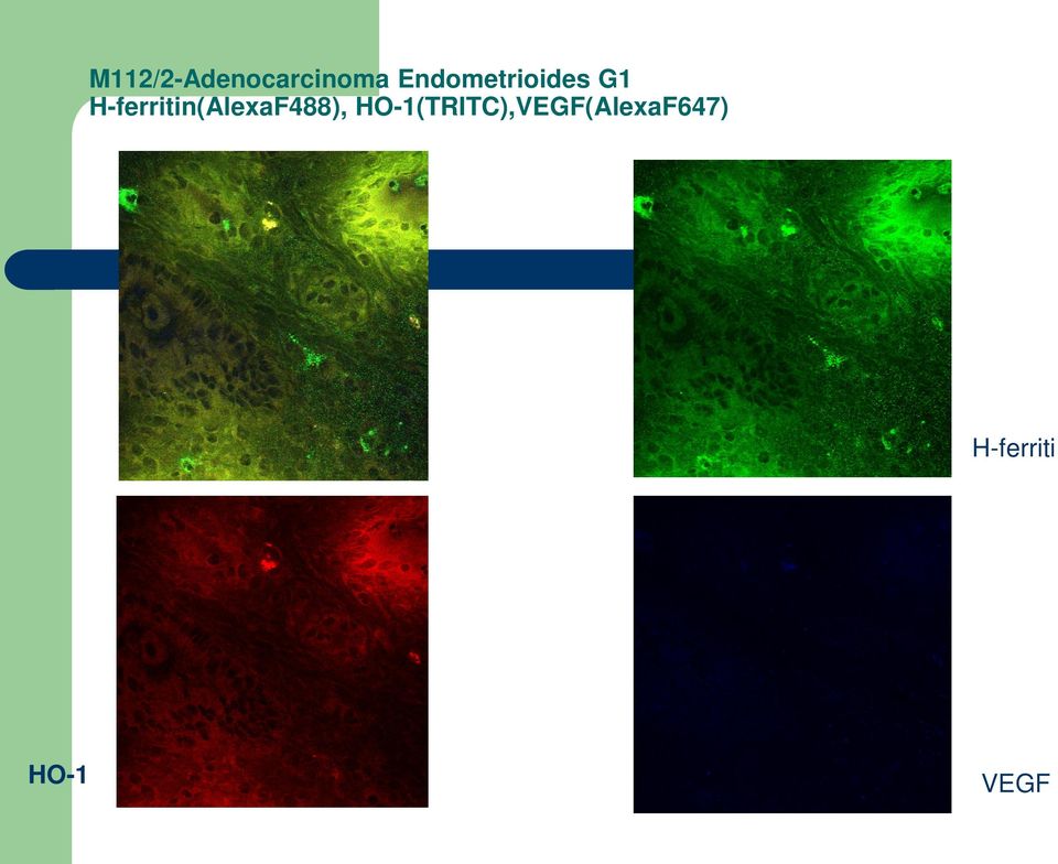 H-ferritin(AlexaF488),