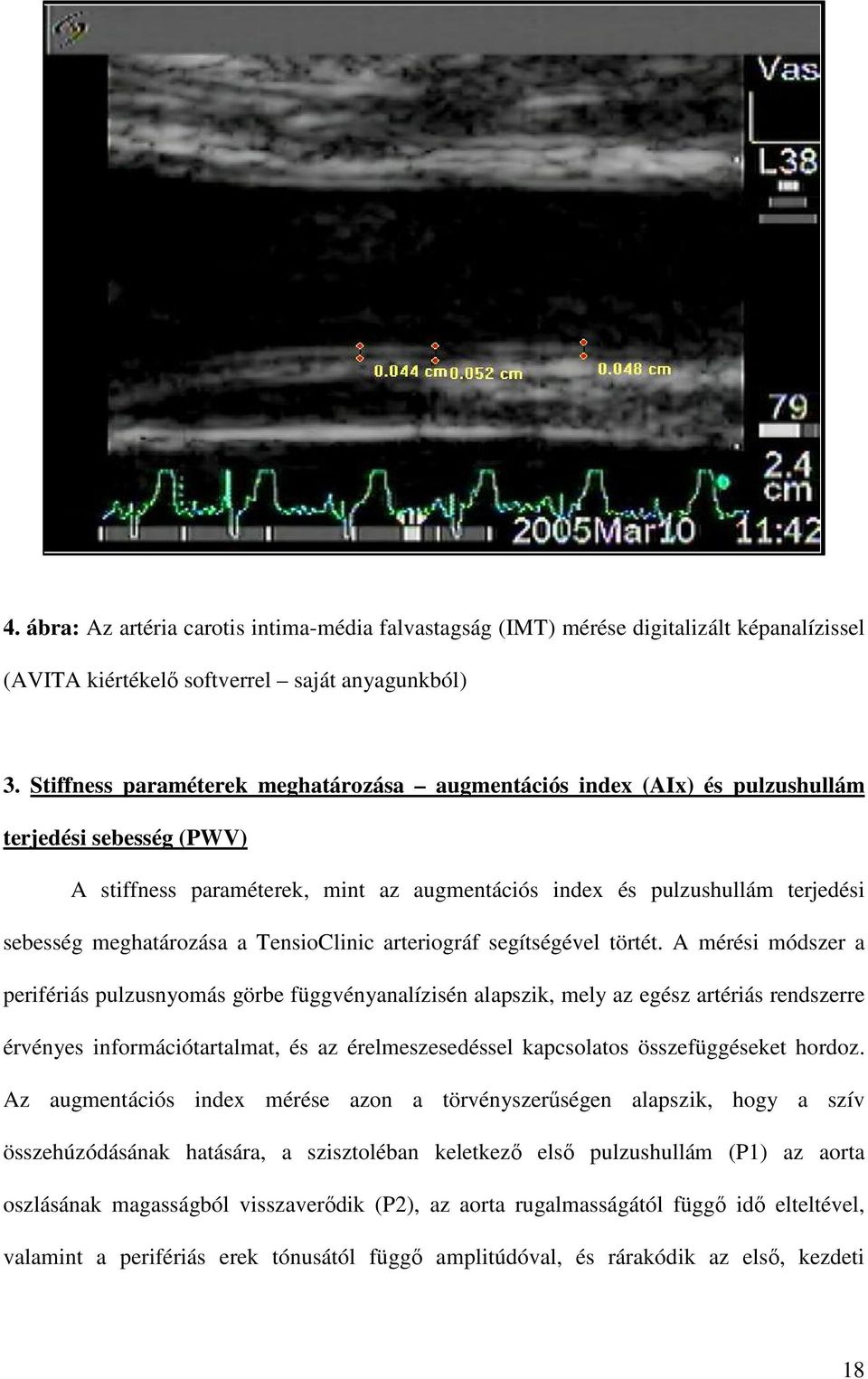 meghatározása a TensioClinic arteriográf segítségével törtét.