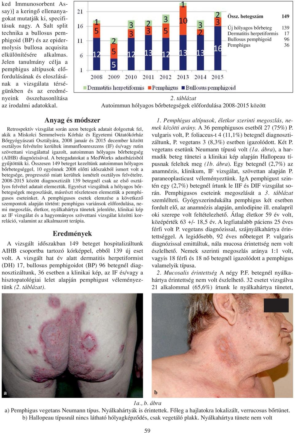 betegszám 149 Új hólyagos bôrbeteg 139 Dermatitis herpetiformis 17 Bullosus pemphigoid 96 Pemphigus 36 2.