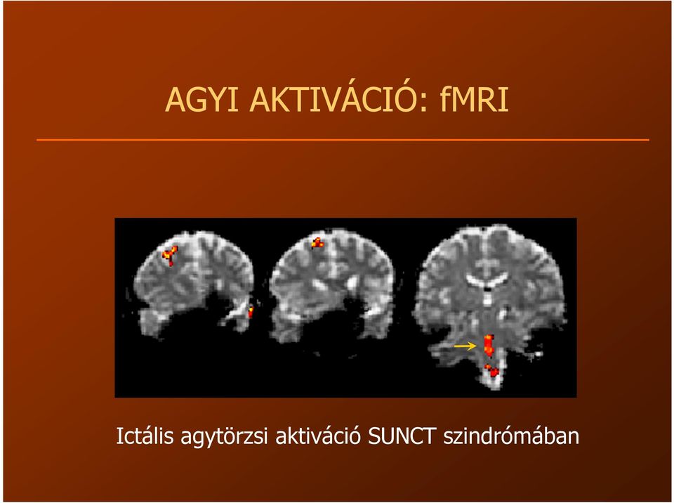 agytörzsi