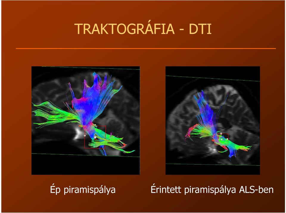 piramispálya