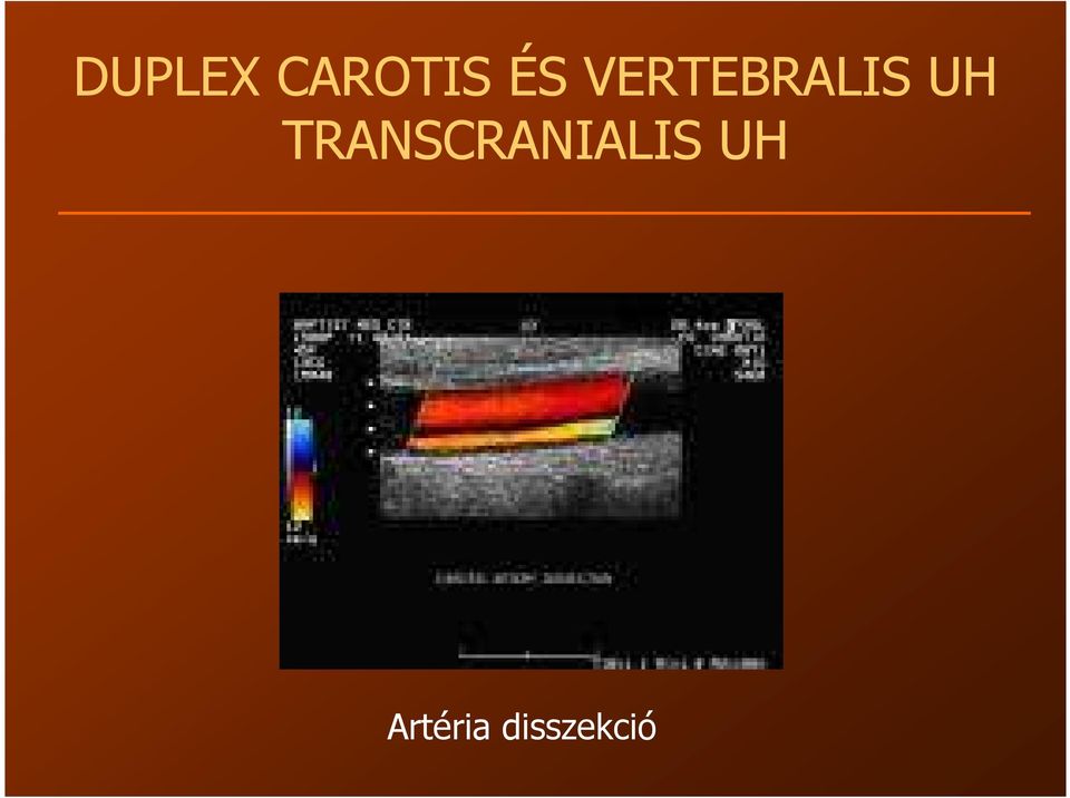 TRANSCRANIALIS UH