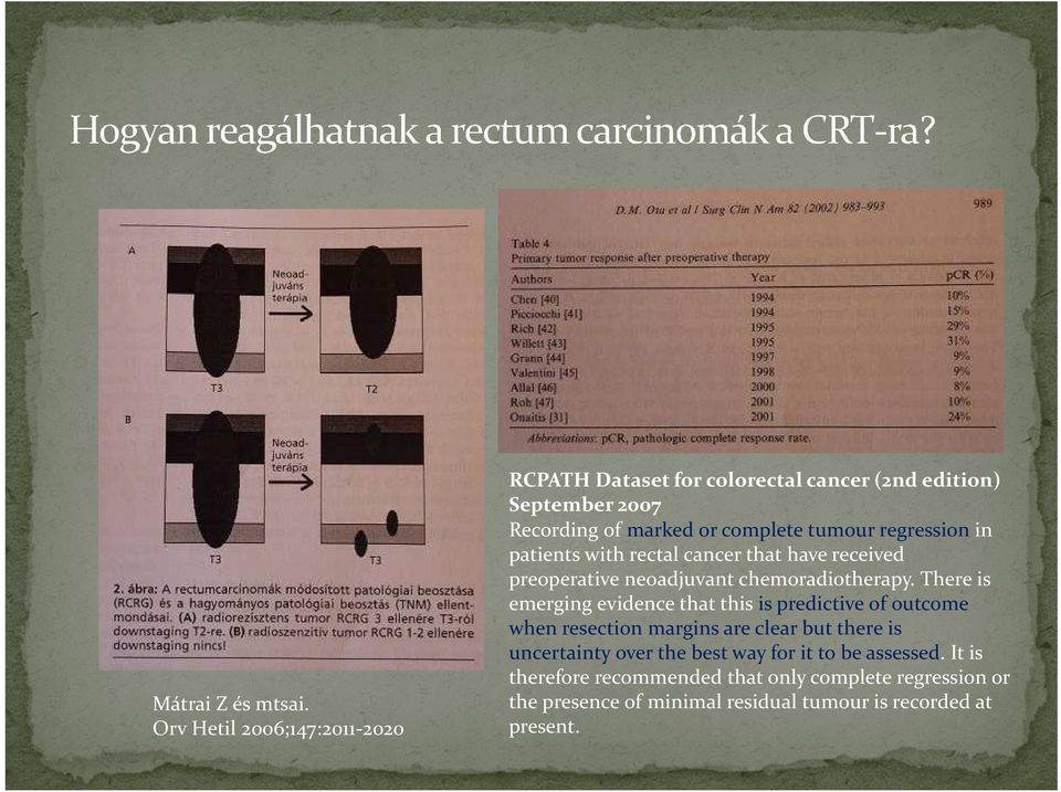 tumourregression in patients with rectal cancer thathave received preoperative neoadjuvantchemoradiotherapy.