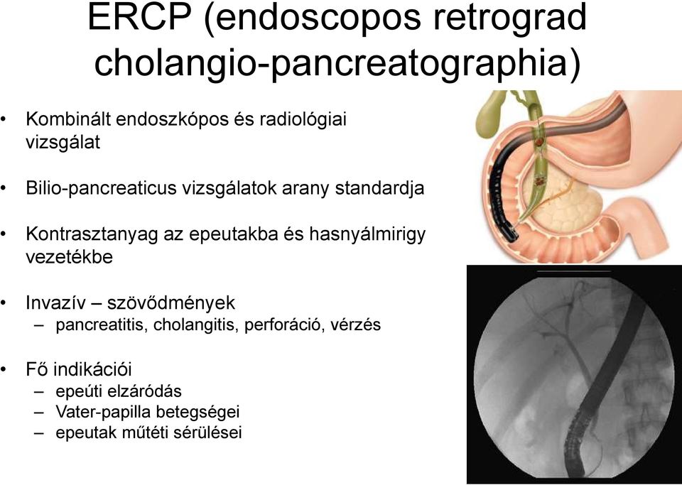 epeutakba és hasnyálmirigy vezetékbe Invazív szövődmények pancreatitis, cholangitis,