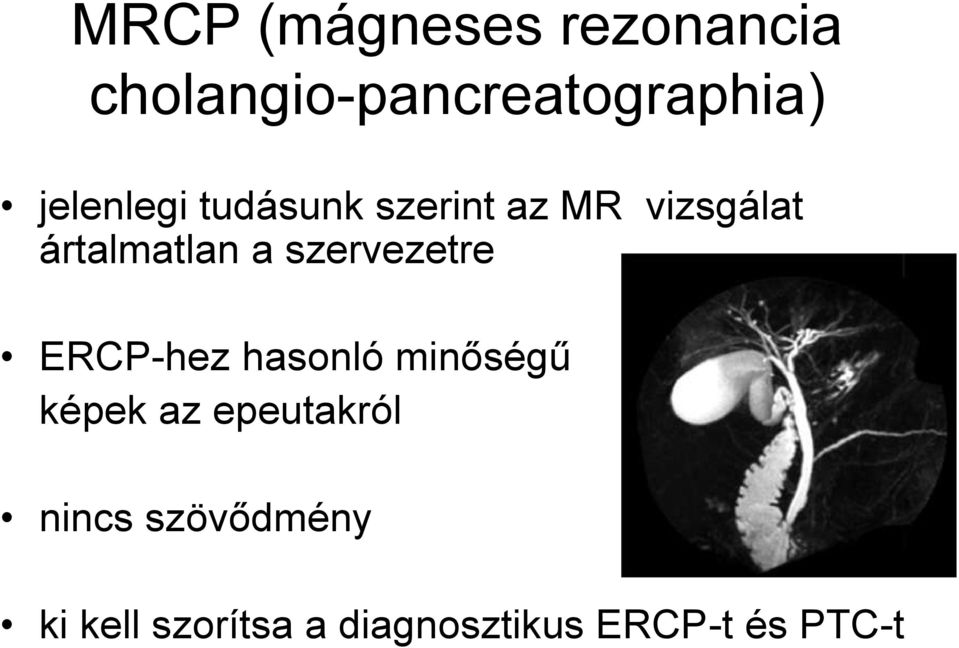 szervezetre ERCP-hez hasonló minőségű képek az epeutakról