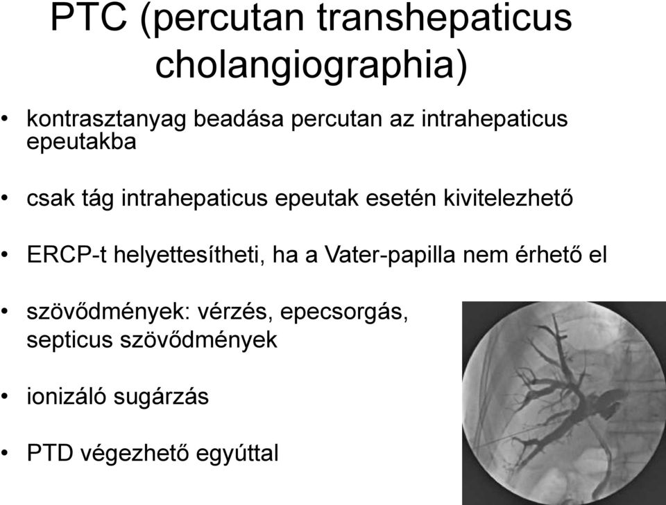 kivitelezhető ERCP-t helyettesítheti, ha a Vater-papilla nem érhető el