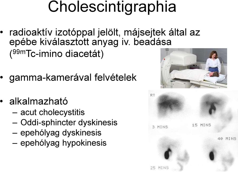 beadása ( 99m Tc-imino diacetát) gamma-kamerával felvételek