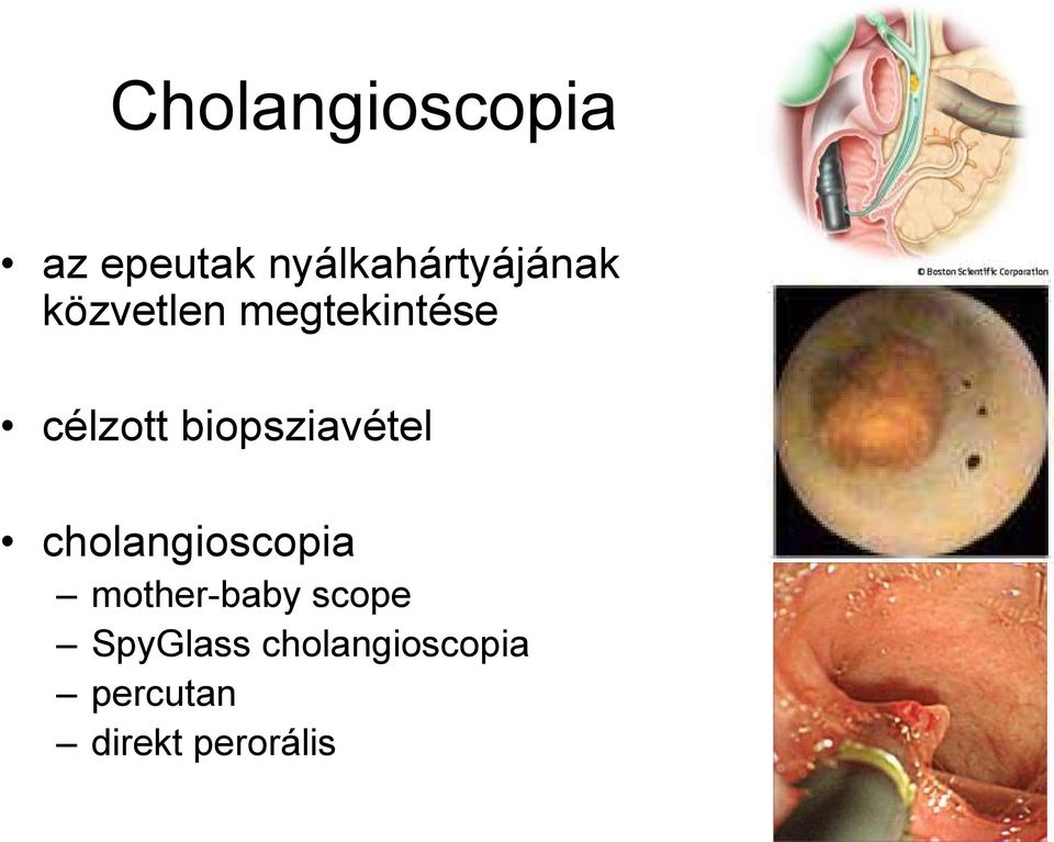 célzott biopsziavétel cholangioscopia