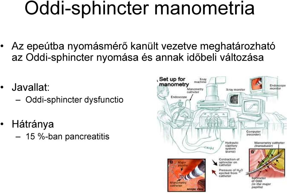 nyomása és annak időbeli változása Javallat: