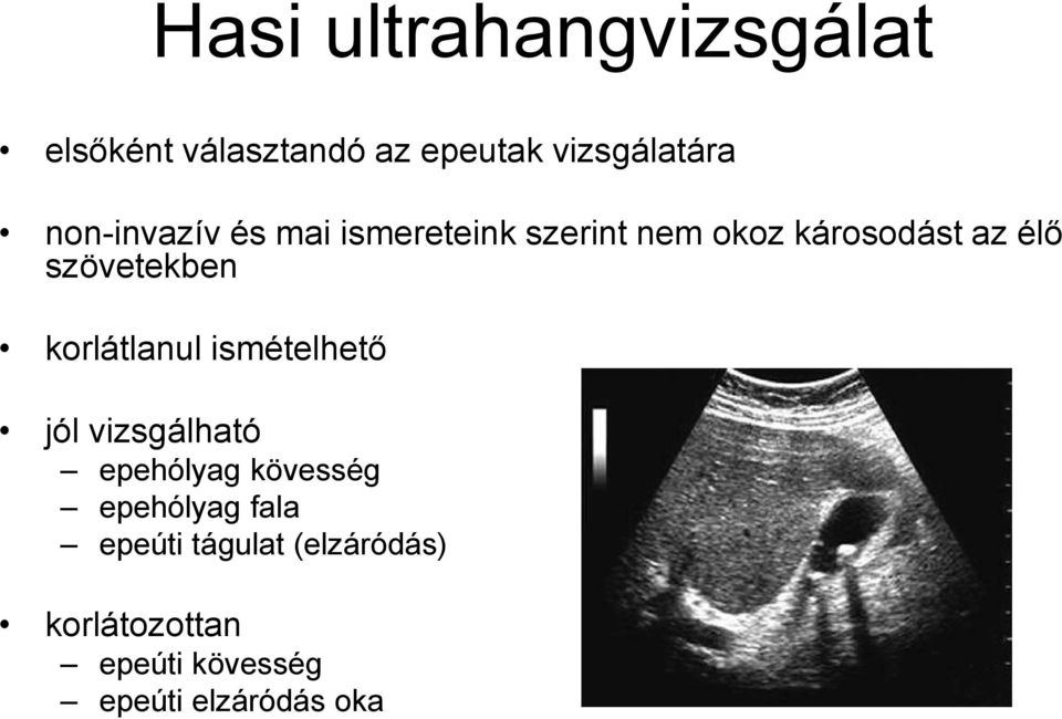 szövetekben korlátlanul ismételhető jól vizsgálható epehólyag kövesség