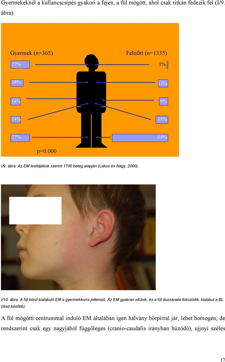 Az EM testtájékok szerint 1700 beteg alapján (Lakos és Nagy, 2000). I/10. ábra. A fül körül kialakuló EM a gyermekkorra jellemző.