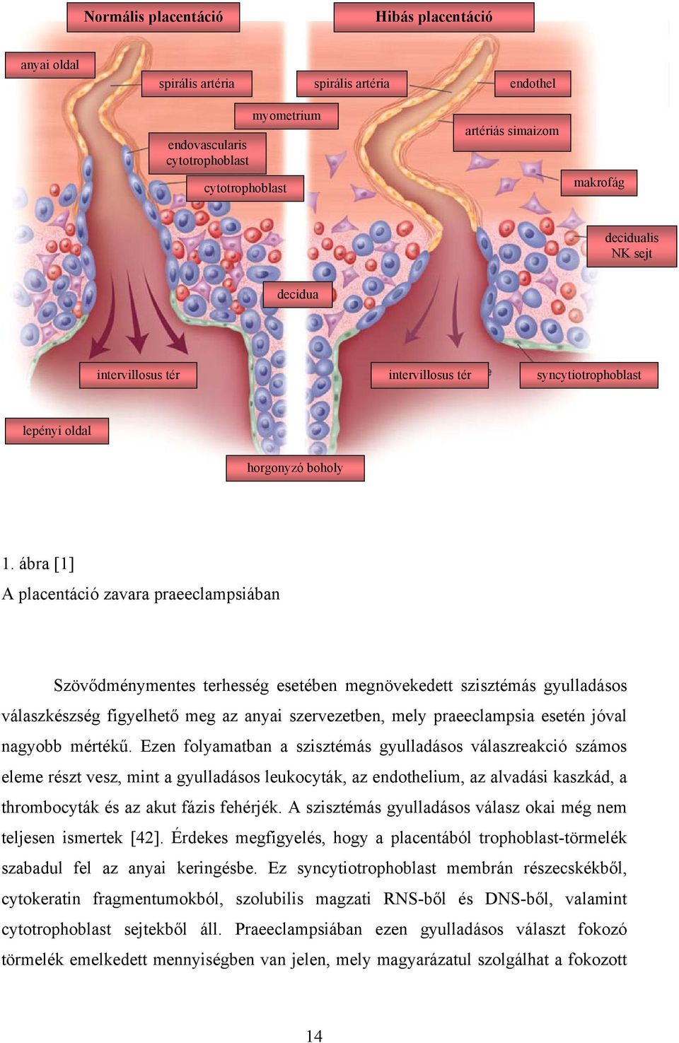 ábra [1] A placentáció zavara praeeclampsiában Szövődménymentes terhesség esetében megnövekedett szisztémás gyulladásos válaszkészség figyelhető meg az anyai szervezetben, mely praeeclampsia esetén