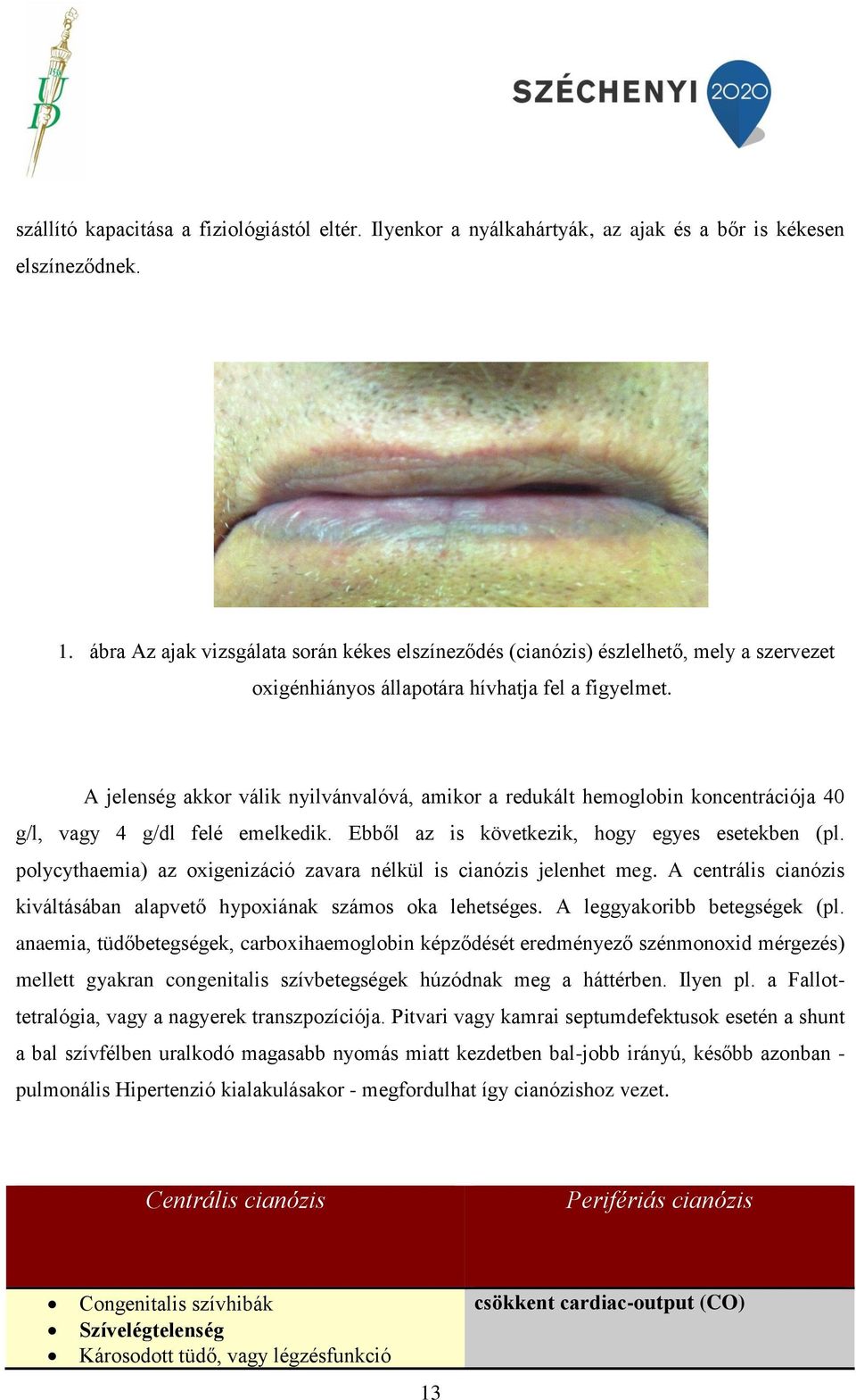 A jelenség akkor válik nyilvánvalóvá, amikor a redukált hemoglobin koncentrációja 40 g/l, vagy 4 g/dl felé emelkedik. Ebből az is következik, hogy egyes esetekben (pl.
