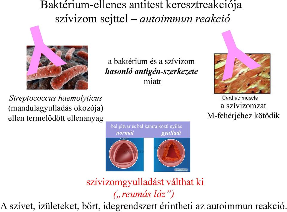 ellenanyag bal pitvar és bal kamra közti nyílás normál gyulladt a szívizomzat M-fehérjéhez kötődik