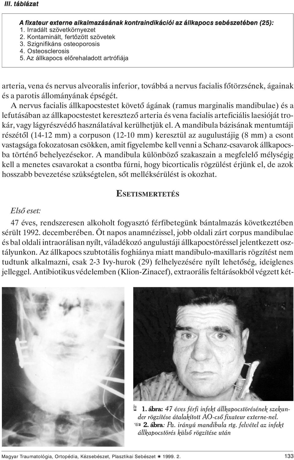 A nervus facialis állkapocstestet követô ágának (ramus marginalis mandibulae) és a lefutásában az állkapocstestet keresztezô arteria és vena facialis arteficiális laesióját trokár, vagy lágyrészvédô